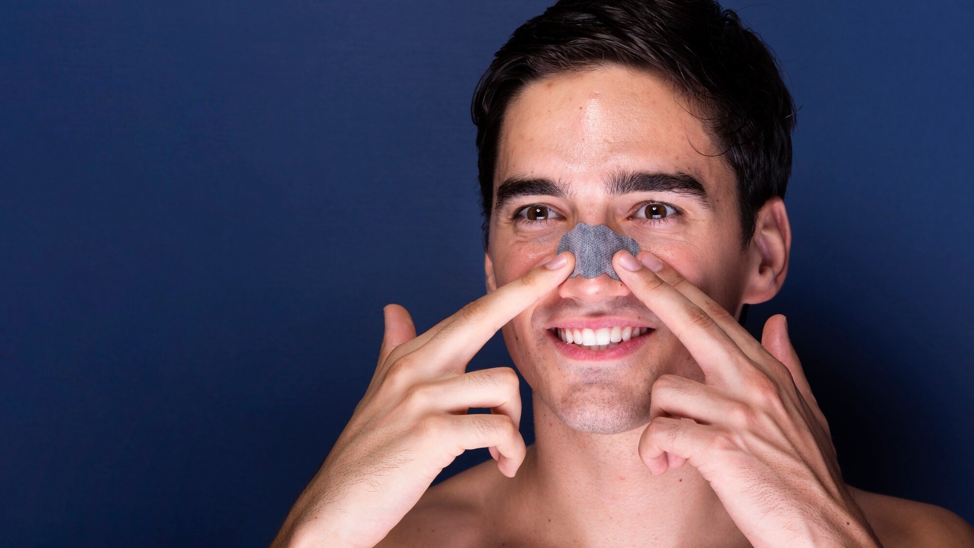 Blackheads